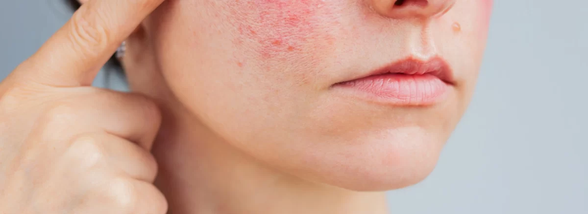 Dermatologė konsultuoja pacientę dėl odos bėrimų Senojo bokšto klinikoje Šiauliuose