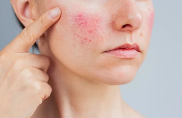 Dermatologė konsultuoja pacientę dėl odos bėrimų Senojo bokšto klinikoje Šiauliuose