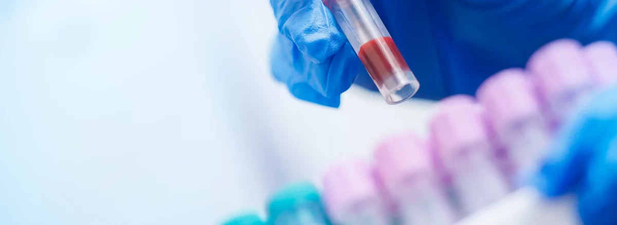Profilaktiniai kraujo tyrimai atliekami laboratorijoje Šiauliuose