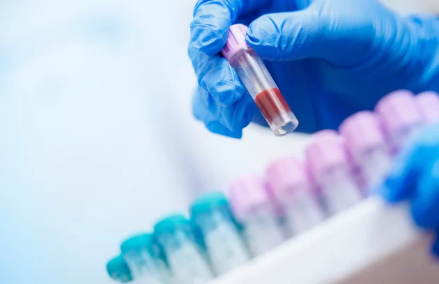 Profilaktiniai kraujo tyrimai atliekami laboratorijoje Šiauliuose